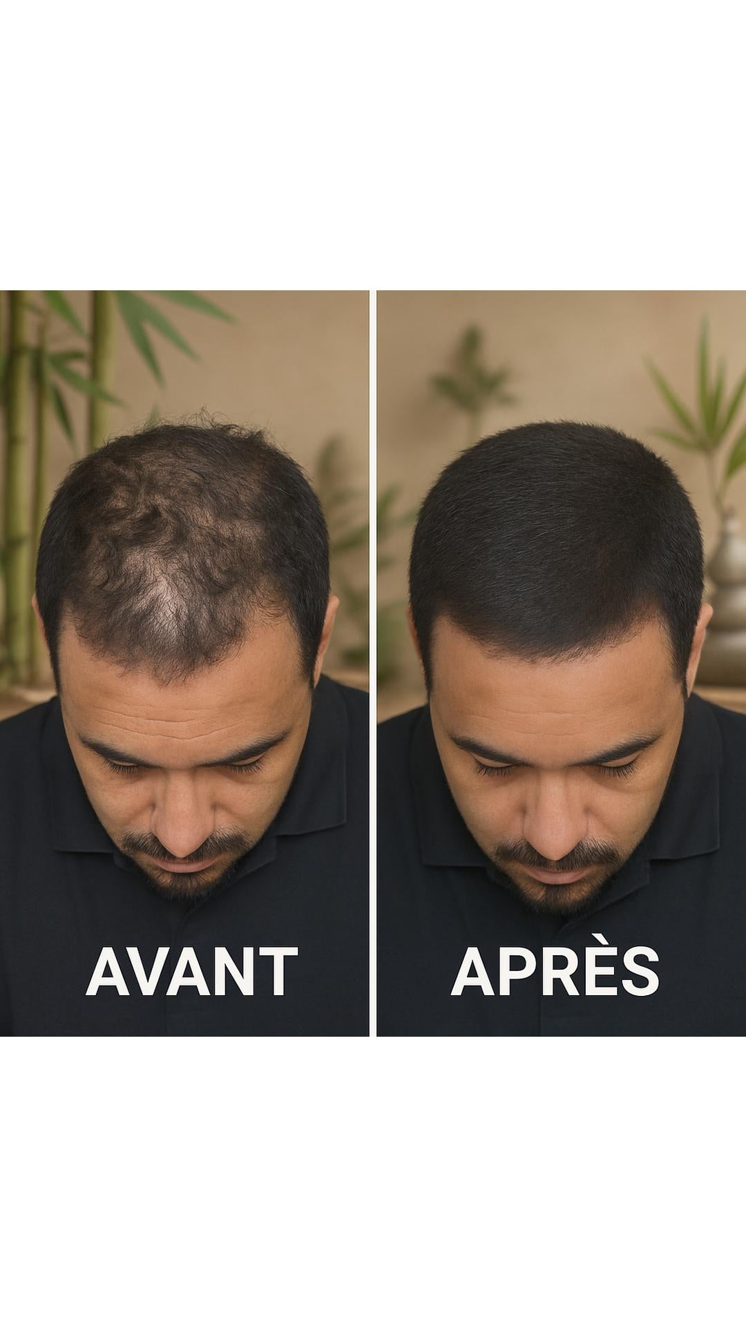Correcteur Capillaire
