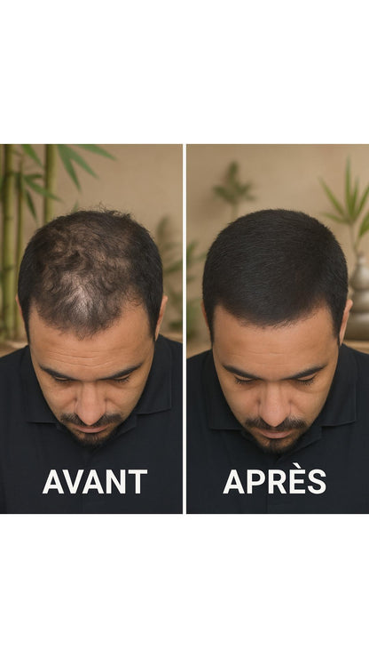 Correcteur Capillaire
